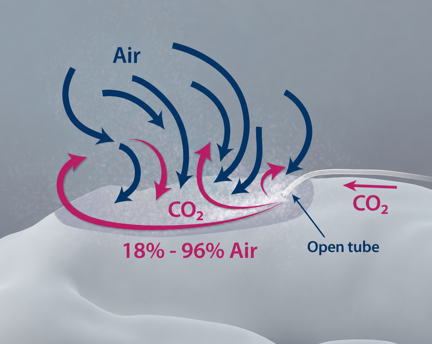 Diagram showing turbulent CO₂ gas flow with substantial mixing of ambient air over the surgical cavity.